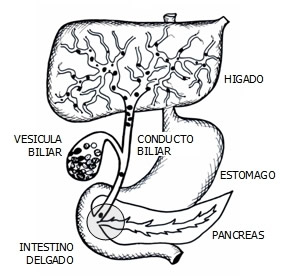 C&aacute;lculos Biliares alojados